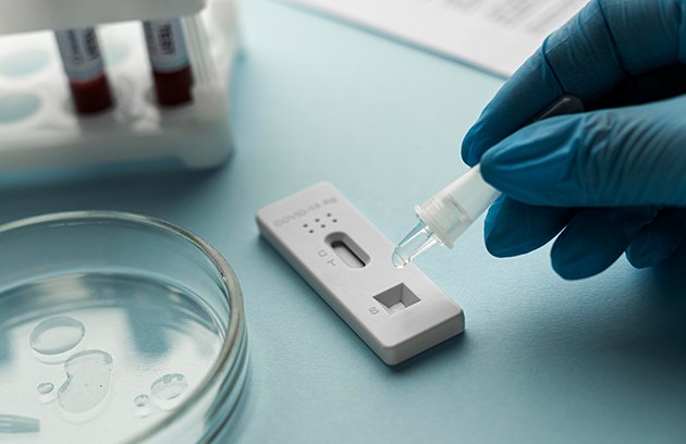 test kit